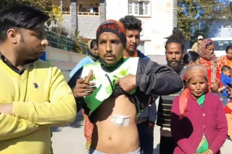 उत्‍तराखंड न्यूज़ : युवक पर हमला करने का आरोपी पुलिस की पकड़ से दूर आक्रोशित ग्रामीणों ने किया प्रदर्शन