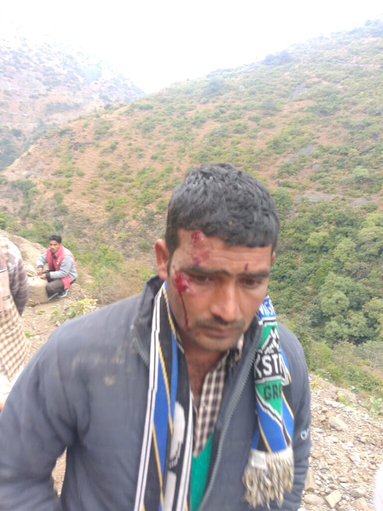 उत्तराखंड न्यूज़ : सड़क पर गड्ढे, लोग हो रहे हादसे के शिकार