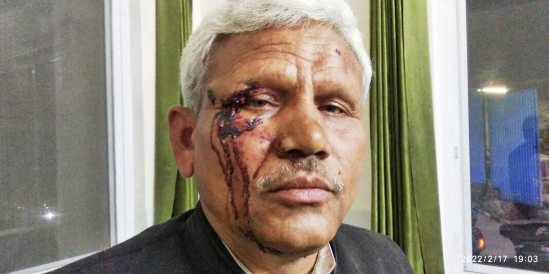 मसूरी उत्‍तराखंड ब्रेकिंग न्यूज़ : उक्रांद प्रत्याशी  बिल्लू बाल्मीकि ने नगर पालिका अध्यक्ष पर लगाया मारपीट का आरोप, दोनों पक्षों ने दी शिकायत
