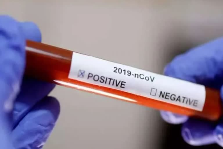 उत्‍तराखंड न्यूज़ : देहरादून की स्कूली छात्रा कोरोना पॉजिटिव मिली , अब सोमवार को स्कूल खुलेगा