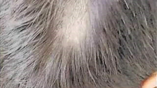 अल्मोड़ा : बाल नहीं काटे तो शिक्षक ने 14 बच्चों के सिर पर चलाया उस्तरा, भड़के माता-पिता