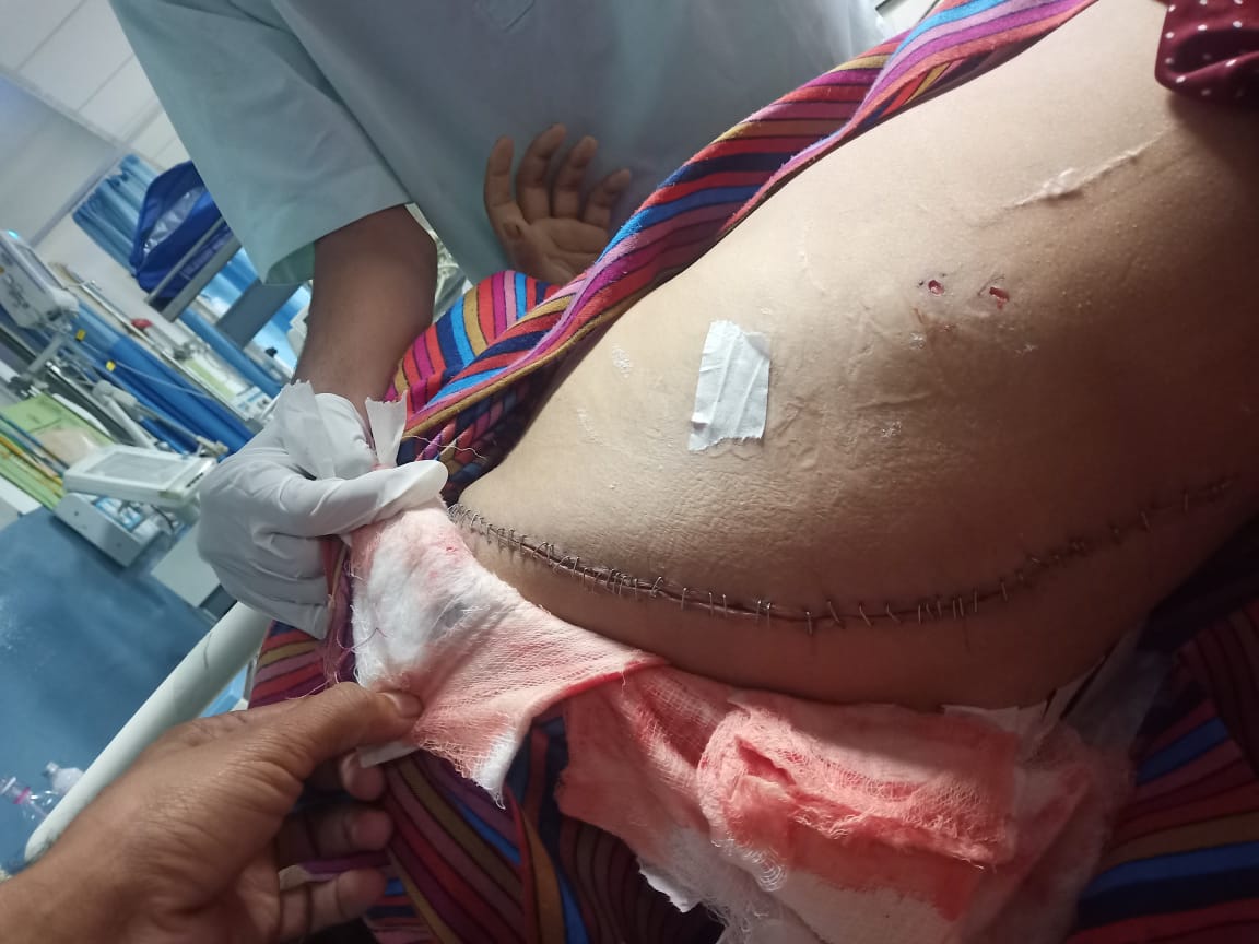 टिहरी गढ़वाल : पुलिस ने परिवार वालों की शिकायत पर इंद्रेश हॉस्पिटल के संचालक के खिलाफ केस दर्ज किया है।