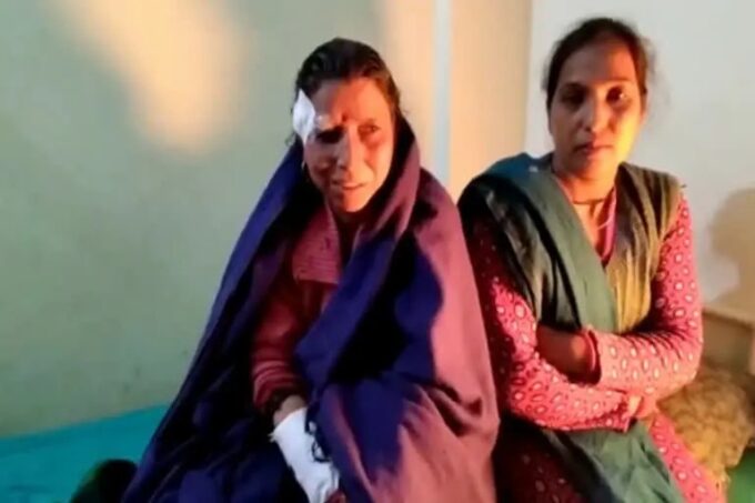जान बचाने के चक्कर में एक महिला गुलदार से टकरा गई, हमले में घायल हो गई