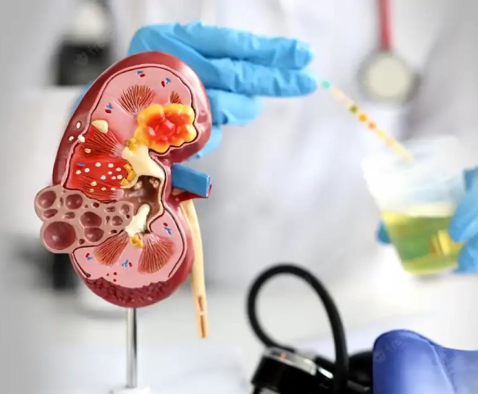 Patients recovering from kidney failure, liver failure, cancer, heart problems shared their experiences.